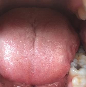 Levi Gonzalez: every cell and I a mouth 